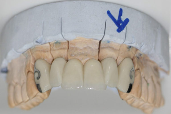 Teeth-design-3