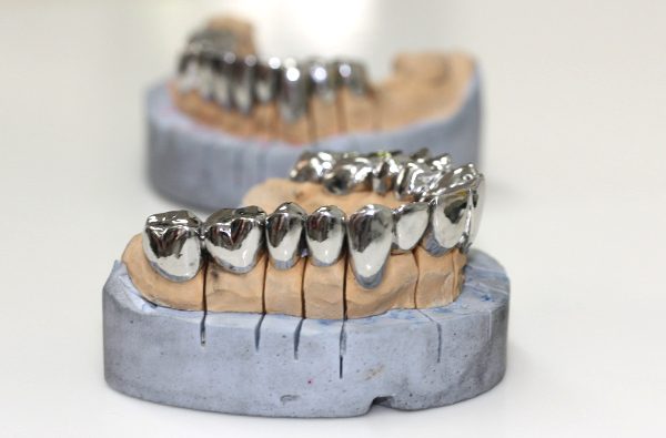 Metal-crowns-2-2